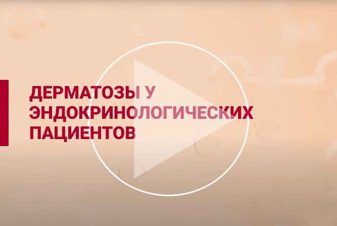 Дерматозы у эндокринологических пациентов